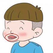 地包天矫正后会反弹吗?