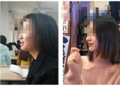 因为一口龅牙，觉得自卑？内向？​