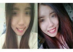 牙齿矫正让您每天都能开口大笑